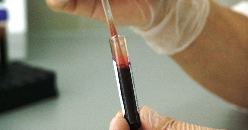 Мононуклеоз опасная болезнь маскируется под COVID-19