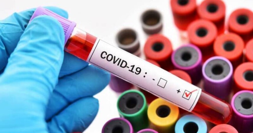 Минздрав дал статистику COVID-19 по регионам. В лидерах - Минск и область а также Витебщина